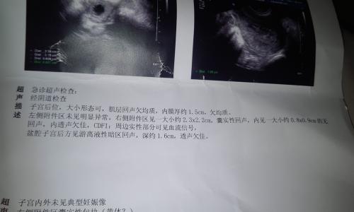 怀孕多久可以做b超排除宫外孕可能性?
