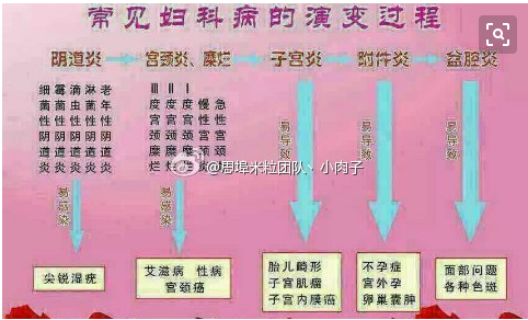 妇科小常识,自查一下