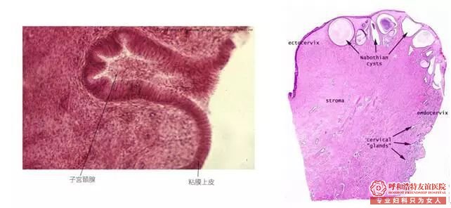 呼和浩特宫颈腺体囊肿——宫颈的“青春痘”
