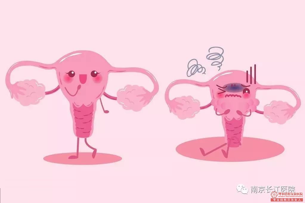 呼市阴道炎“纠缠”着75%的女性,不想受其困扰,注意这些!